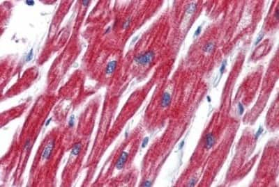 Immunohistochemistry-Paraffin: OLFM4 Antibody [NBP3-14432] - Immunohistochemistry of formalin-fixed, paraffin-embedded human heart after heat-induced antigen retrieval.